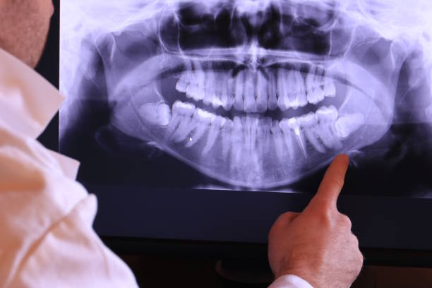 Best Emergency Treatment for Dental Infections or Abscesses in Colby, WI