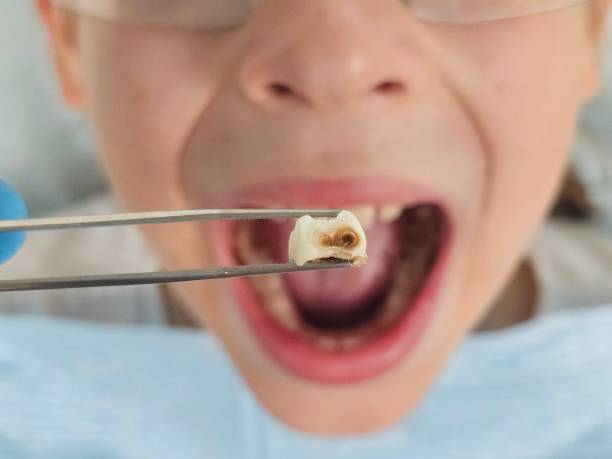 Best Weekend Emergency Dentist in Colby, WI